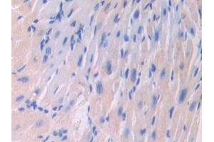 Used in DAB staining on fromalin fixed paraffin- embedded liver tissue (IL18RAP 抗体  (AA 396-548))