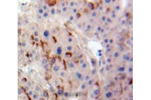 Used in DAB staining on fromalin fixed paraffin-embedded Liver tissue (ADCY4 抗体  (AA 352-541))
