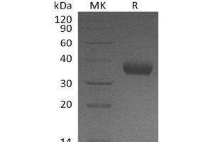 Western Blotting (WB) image for Prolactin Receptor (PRLR) protein (His tag) (ABIN7320719)