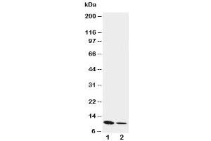 Western blot testing of Resistin antibody and Lane 1:  recombinant mouse protein 10ng (Resistin 抗体  (C-Term))