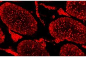 IF analysis of SAE1 using anti-SAE1 antibody (ABIN7601346).