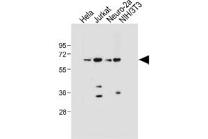 All lanes : Anti-SD4 Antibody  at 1:1000 dilution Lane 1: Hela whole cell lysate Lane 2: Jurkat whole cell lysate Lane 3: Neuro-2a whole cell lysate Lane 4: NIH/3T3 whole cell lysate Lysates/proteins at 20 μg per lane. (SMAD4 抗体  (AA 255-284))