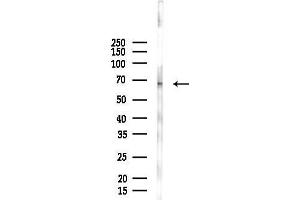 Western blot analysis of lysates from F10-LUC cells(heat-shock 45 min treatment), using TCTN3 Antibody at 1/1000 dilution.