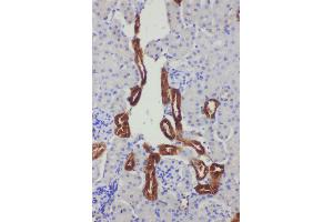 Anti-Kallikrein 1 antibody, IHC(P) IHC(P): Mouse Kidney Tissue (Kallikrein 1 抗体  (C-Term))