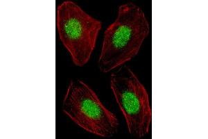 Immunofluorescence (IF) image for anti-Nuclear Receptor Subfamily 1, Group H, Member 3 (NR1H3) antibody (ABIN5024918) (NR1H3 抗体)