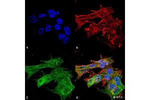 Immunocytochemistry/Immunofluorescence analysis using Mouse Anti-Versican Monoclonal Antibody, Clone S351-23 . (Versican 抗体  (AA 362-585) (PerCP))