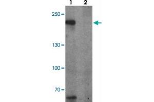 Western blot analysis of TET3 in SK-N-SH cell lysate with TET3 polyclonal antibody  at 1 ug/ml in (1) the absence and (2) the presence of blocking peptide. (TET3 抗体  (AA 1520-1570))