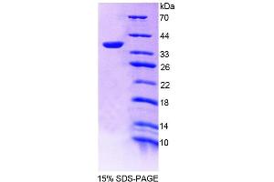 SDS-PAGE analysis of Human TMEM1 Protein. (TRAPPC10 蛋白)