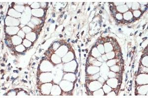Immunohistochemistry of paraffin-embedded Human colon using APC Polyclonal Antibody at dilution of 1:200 (40x lens). (APC 抗体)
