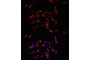 Immunofluorescence analysis of C6 cells using TMEM11 antibody (ABIN7270952) at dilution of 1:100. (TMEM11 抗体  (AA 1-80))