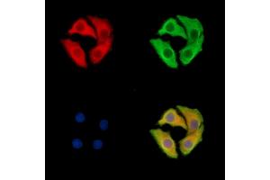 ABIN7095997 and ABIN7100059 staining Hela cells by IF/ICC.