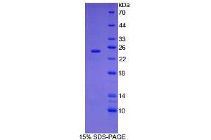 SDS-PAGE analysis of General STAT3 Protein. (STAT3 蛋白)