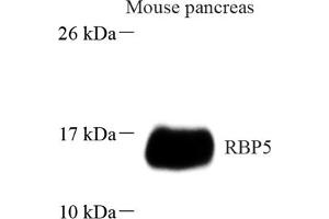 Western blot analysis of RBP5 (ABIN7075410) at dilution of 1: 1000 (Retinol Binding Protein 5 抗体)