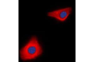Immunofluorescent analysis of Caspase 10 staining in Jurkat cells. (Caspase 10 抗体  (C-Term))