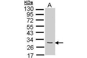 WB Image Sample (35 ug of whole cell lysate) A: synovial fibroblast 12% SDS PAGE antibody diluted at 1:1000 (FGF10 抗体)