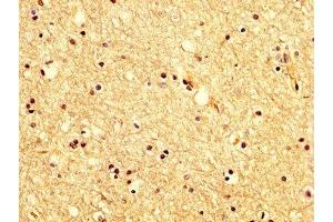 Immunohistochemistry (IHC) image for anti-Potassium Voltage-Gated Channel, Shaker-Related Subfamily, beta Member 1 (KCNAB1) (AA 287-401) antibody (ABIN7175618)