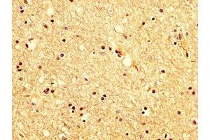 IHC image of ABIN7175618 diluted at 1:200 and staining in paraffin-embedded human brain tissue performed on a Leica BondTM system. (KCNAB1 抗体  (AA 287-401))