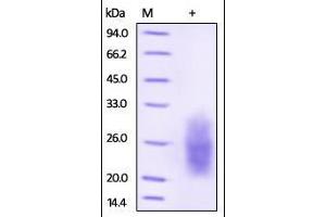 SDS-PAGE (SDS) image for Natural Cytotoxicity Triggering Receptor 3 (NCR3) (AA 19-135) protein (His tag) (ABIN2181530)
