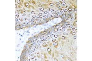 Immunohistochemistry of paraffin-embedded human esophagus using S100/Psoriasin antibody (ABIN3015738, ABIN3015739, ABIN3015740 and ABIN6219085) at dilution of 1:100 (40x lens). (S100A7 抗体  (AA 1-101))