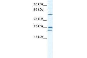 WB Suggested Anti-GJB2 Antibody Titration:  1. (GJB2 抗体  (Middle Region))