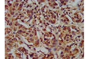 Immunohistochemistry (IHC) image for anti-Cytochrome P450, Family 8, Subfamily B, Polypeptide 1 (CYP8B1) (AA 303-440) antibody (ABIN7142850)