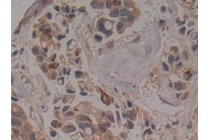 Immunohistochemistry (IHC) image for anti-Coilin (COIL) (AA 319-538) antibody (ABIN7444124)