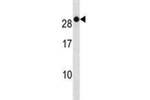 RAB7B antibody western blot analysis in A2058 lysate. (RAB7B 抗体  (AA 168-197))