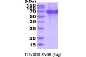 SDS-PAGE (SDS) image for EPH Receptor B2 (EPHB2) (AA 19-543) protein (His tag) (ABIN7281187)