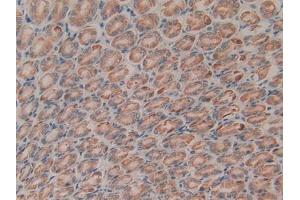 DAB staining on IHC-P; Samples: Rat Liver Tissue (CTGF 抗体  (AA 25-347))