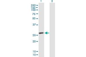 Western Blot analysis of IDI2 expression in transfected 293T cell line by IDI2 MaxPab polyclonal antibody. (IPP Isomerase 2 抗体  (AA 1-227))