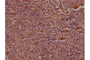 Immunohistochemistry (IHC) image for anti-CD19 Molecule (CD19) (AA 20-291) antibody (ABIN7147134)