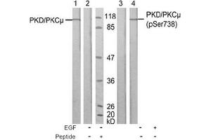 Image no. 1 for anti-Protein Kinase D1 (PRKD1) (Ser738) antibody (ABIN197312) (PKC mu 抗体  (Ser738))