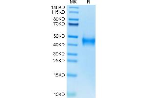 Human Coagulation Factor III on Tris-Bis PAGE under reduced condition. (Tissue factor Protein (AA 33-251) (His tag))