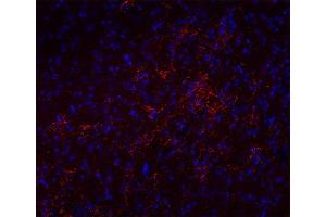 Immunohistochemistry (IHC) image for anti-Solute Carrier Family 17 (Sodium-Dependent Inorganic Phosphate Cotransporter), Member 8 (SLC17A8) (AA 543-601), (C-Term) antibody (ABIN1742302)