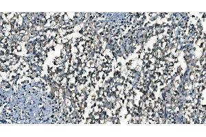 IHC analysis of CDC45L using anti-CDC45L antibody (ABIN7600230).