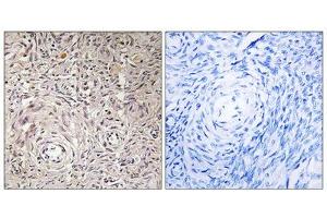 Immunohistochemistry analysis of paraffin-embedded human ovary tissue using GCNT7 antibody. (GCNT7 抗体  (C-Term))