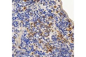 Immunohistochemistry of paraffin embedded mouse spleen using septin1 (ABIN7074453) at dilution of 1: 700 (400x lens)