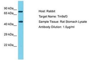 Image no. 1 for anti-Transmembrane 9 Superfamily Member 3 (TM9SF3) (AA 187-236) antibody (ABIN6750318) (TM9SF3 抗体  (AA 187-236))