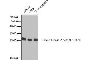 Western blot analysis of extracts of various cell lines, using Casein Kinase 2 beta (Casein Kinase 2 beta (CSNK2B)) Rabbit pAb  at 1:1000 dilution. (CSNK2B 抗体  (AA 1-215))