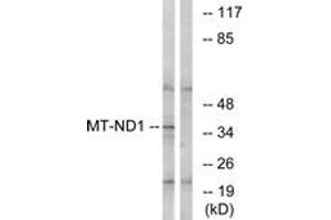 Western blot analysis of extracts from Jurkat cells, using MT-ND1 Antibody.