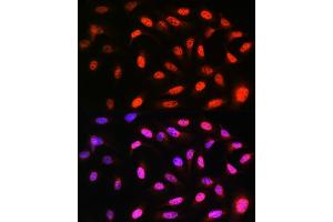 Immunofluorescence analysis of U-2 OS cells using VCP Rabbit mAb (ABIN7271284) at dilution of 1:100 (40x lens). (VCP 抗体)