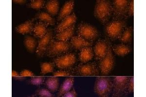 Immunofluorescence analysis of HeLa cells using SMYD3 Polyclonal Antibody at dilution of 1:100. (SMYD3 抗体)