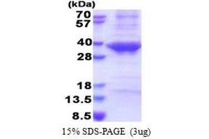 SDS-PAGE (SDS) image for Cathepsin E (CTSE) (AA 57-363) protein (His tag) (ABIN5853580) (Cathepsin E Protein (CTSE) (AA 57-363) (His tag))