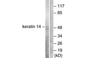 Western blot analysis of extracts from NIH-3T3 cells, using Keratin 14 Antibody. (KRT14 抗体  (AA 1-50))