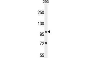 ZBTB10 Antibody (C-term) western blot analysis in 293 cell line lysates (35 µg/lane).
