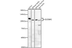 Western blot analysis of extracts of various cell lines, using SECISBP2 antibody (ABIN6128699, ABIN6147497, ABIN6147498 and ABIN6222461) at 1:500 dilution. (SECISBP2 抗体  (AA 585-854))