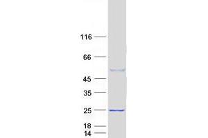 Western Blotting (WB) image for Calcyphosine-Like (CAPSL) (Transcript Variant 1) protein (Myc-DYKDDDDK Tag) (ABIN2713045)