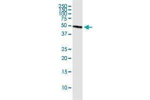 Immunoprecipitation of PLEKHA1 transfected lysate using rabbit polyclonal anti-PLEKHA1 and Protein A Magnetic Bead (PLEKHA1 (人) IP-WB Antibody Pair)