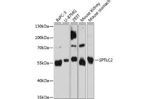 Western blot analysis of extracts of various cell lines, using SPTLC2 Antibody (ABIN6132682, ABIN6148411, ABIN6148412 and ABIN6215412) at 1:3000 dilution. (SPTLC2 抗体  (AA 423-562))