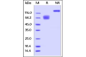 SDS-PAGE (SDS) image for CD58 (CD58) (AA 29-215) (Active) protein (Fc Tag) (ABIN5526666)